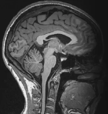 TSD Imaging processing pipeline